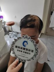 -唐风采假发补发定制