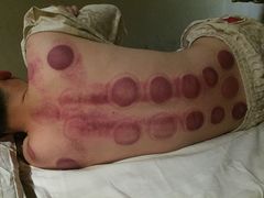 -莱蔻·圣灸堂·推拿艾灸(天山店)