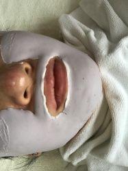 -苗方清颜专业祛痘连锁机构