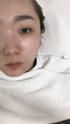 -蕾特恩专业祛痘国际连锁