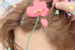 -大麦微针植发全国连锁