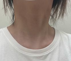 体验后-恒妍医美·韩国定制抗衰中心