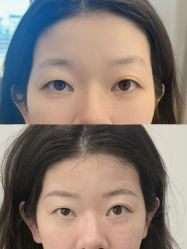 -张小野·专业半永久纹眉