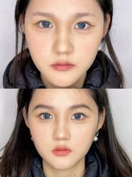 点击看大图 -杨益美学·野生眉半永久纹眉发际线