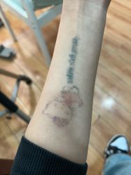 -一次性洗纹身·修复疤痕·超皮秒
