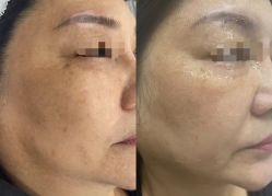 -Cream88颜皮肤管理中心