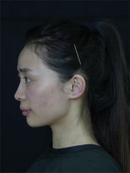 -Yestar重庆艺星医疗美容医院