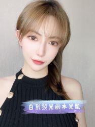 体验后-广州健丽·去眼袋医疗美容机构