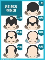 -唐风采假发补发定制