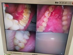 -诺贝尔一诺口腔医院(雁塔院区)
