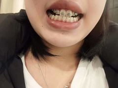 -极光口腔·矫正种植修复(锦江店)