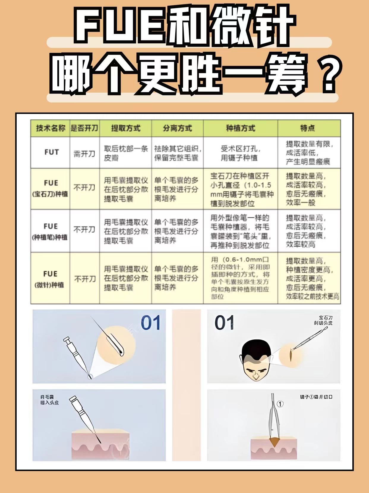 微针植发技术图片