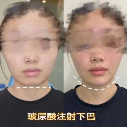 -Yestar重庆艺星医疗美容医院