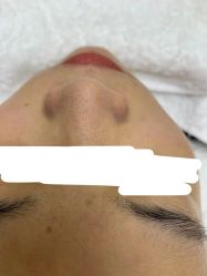 -痘院长·祛痘·科技美肤