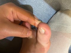 -新甲连锁灰指甲·甲沟炎·鸡眼(黑龙江路店)