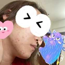 -痘院长·祛痘·皮肤管理