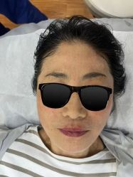 -洁铭新加坡医美