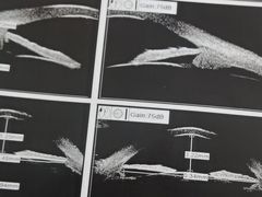 -武汉大学附属爱尔眼科医院(湖北总院)