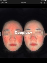 -Deeplus+韩国皮肤管理한국피부관리·C:Lab肌肤实验室