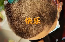 -大麦微针植发全国连锁