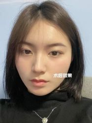 -广州美莱医疗美容医院