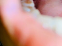 -华中科技大学同济医学院附属同济医院(汉口院区)