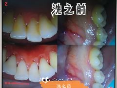 -美酷口腔牙齿矫正(江桥万达店)