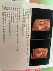 -武汉都市妇产医院