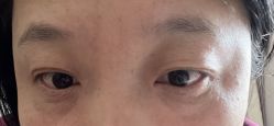 -天津健丽·去眼袋医疗美容机构