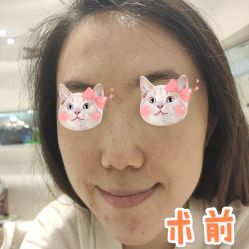 -洁铭新加坡医美