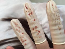 -宜肤清颜专业祛痘问题肌修护