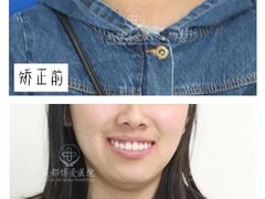 -团圆口腔·种植中心(锦江院区)