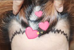 -大麦微针植发全国连锁