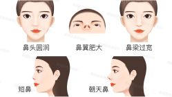 -北京米扬丽格医疗美容·联合丽格鼻整形中心