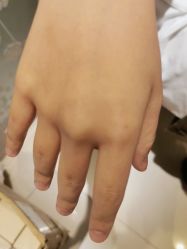 -薇兰专业脱毛连锁机构