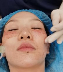 体验后-上海玫瑰医疗美容医院