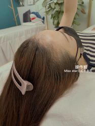 -MISS STAR·半永久纹眉·发际线·美瞳线