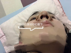 -素美医疗美容·西南眼鼻整形·修复基地