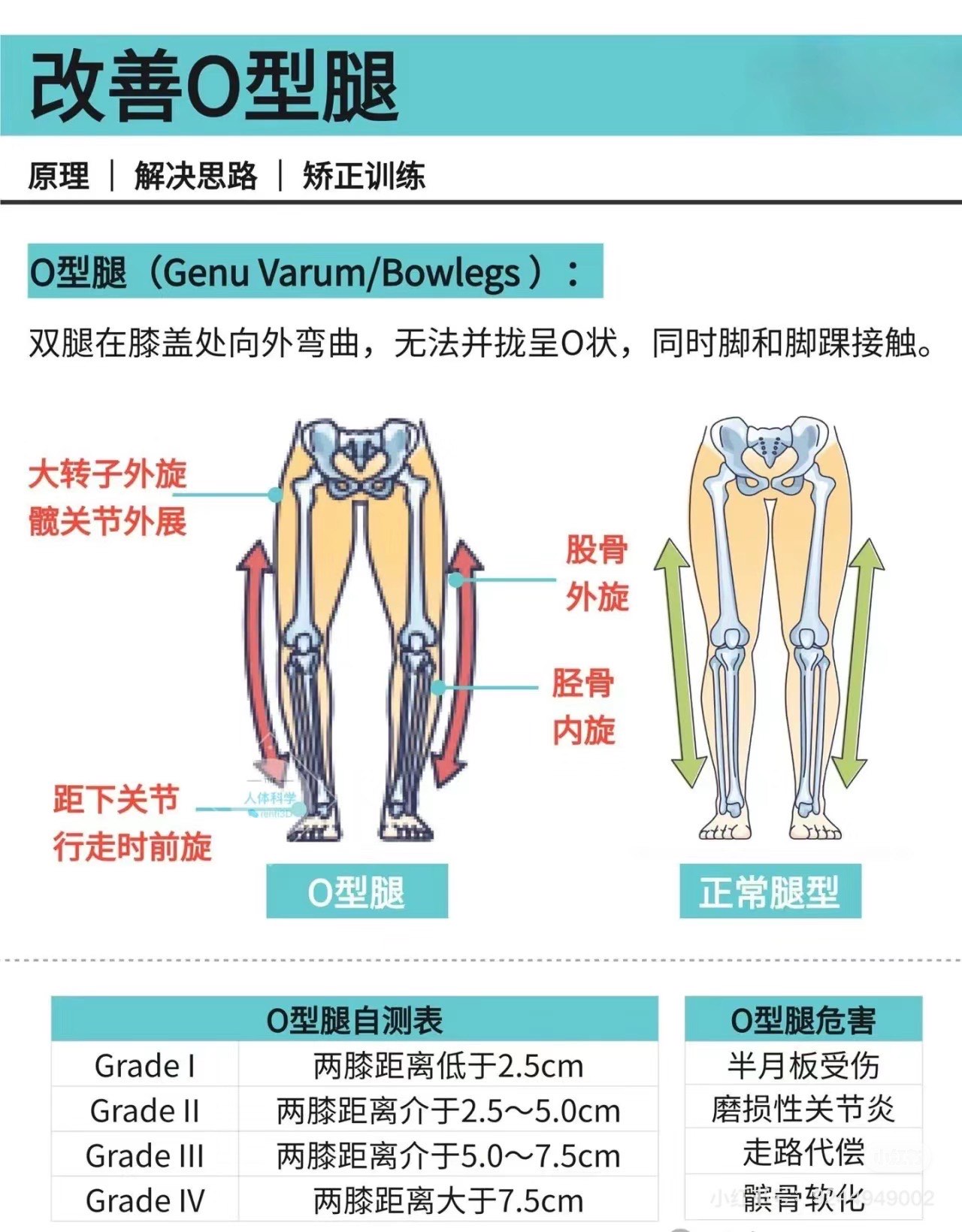 正常的腿型 标准图片