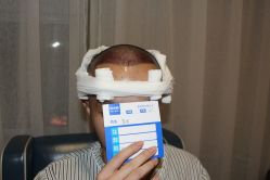 -大麦微针植发丨全国连锁