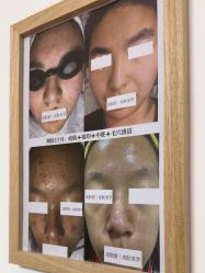 -美肤盾祛痘·问题肌头疗管理中心