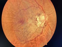 -宝岛眼镜(太原科技街店)