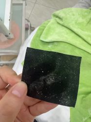 点击看大图 -苗医生草本科技祛痘