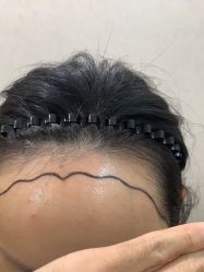 -熙朵美学植发·连锁品牌