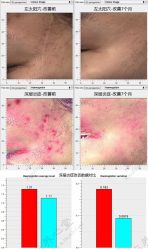 -皇族养心堂·净痘·修敏·御颜