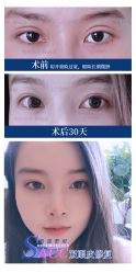 -丰联丽格医疗美容·联合丽格眼整形中心