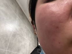 -Yestar宁波艺星整形医院