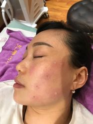 -痣清宫祛斑祛痣连锁店