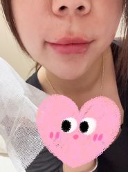 -深圳鹏爱秀琪医疗美容医院