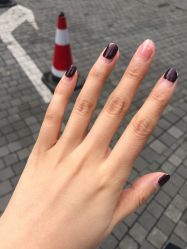 -嘉和医学脱毛中心